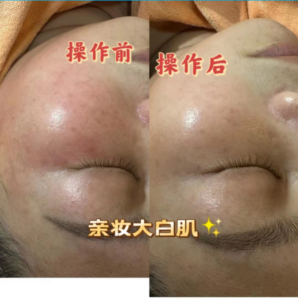 大白肌_12.jpg