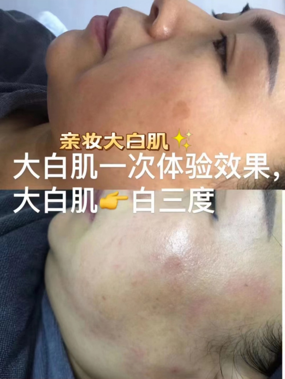 大白肌_13.jpg