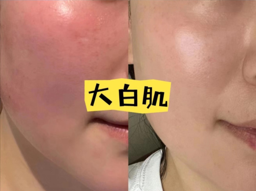 大白肌_14.jpg