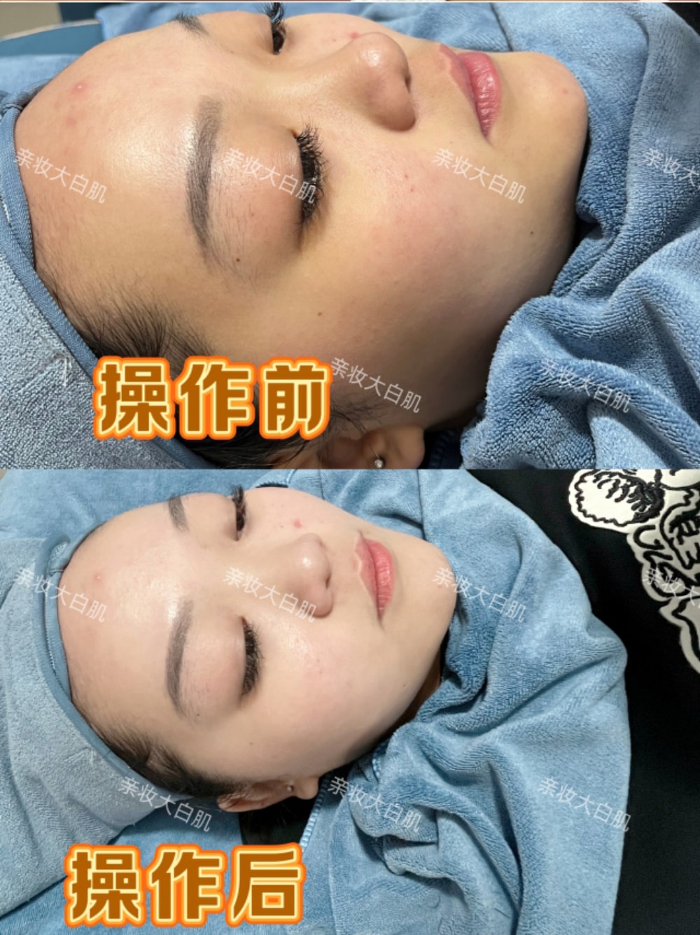 大白肌_15.jpg