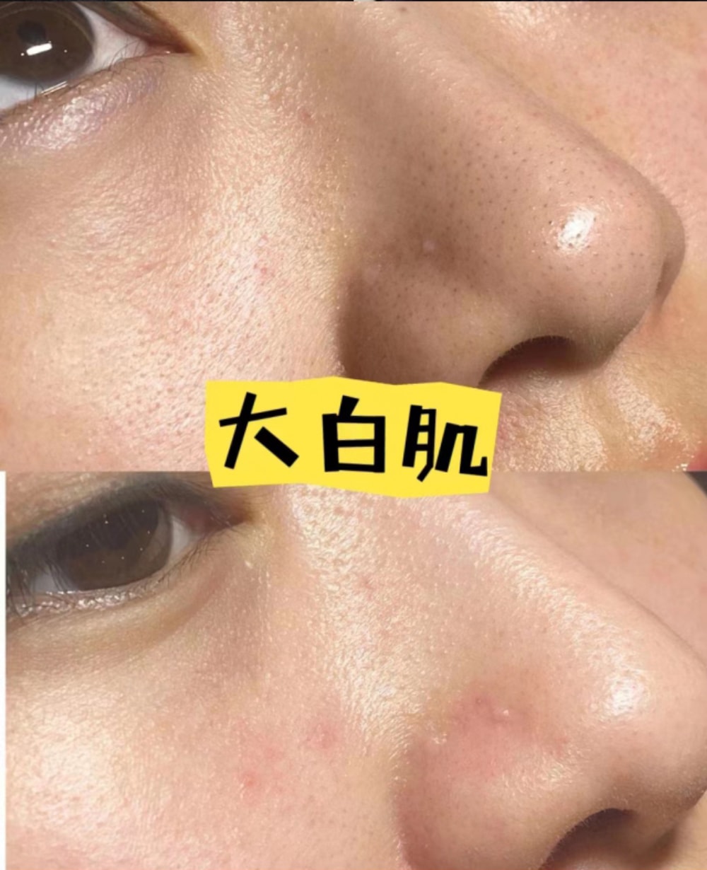 大白肌_17.jpg