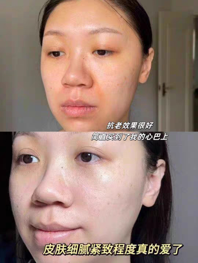 胶原蛋白冻干丝修护套_06.jpg