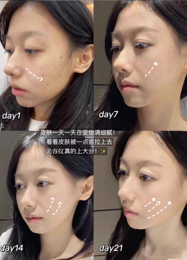 胶原蛋白冻干丝修护套_07.jpg