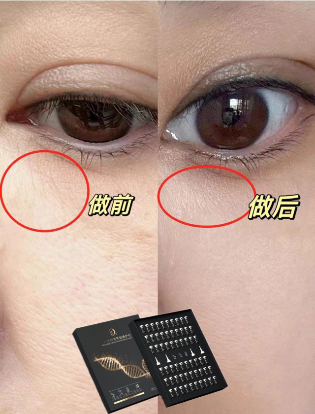 胶原蛋白冻干丝修护套_12.jpg